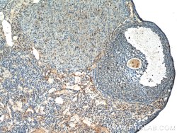 THADA Rabbit anti-Human, Mouse, Rat, Polyclonal, Proteintech:Antibodies:Primary