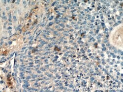 THADA Rabbit anti-Human, Mouse, Rat, Polyclonal, Proteintech:Antibodies:Primary