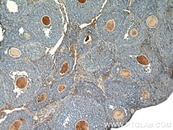 THADA Rabbit anti-Human, Mouse, Rat, Polyclonal, Proteintech:Antibodies:Primary