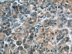 THADA Rabbit anti-Human, Mouse, Rat, Polyclonal, Proteintech:Antibodies:Primary