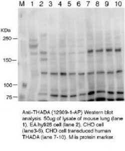 THADA Rabbit anti-Human, Mouse, Rat, Polyclonal, Proteintech:Antibodies:Primary