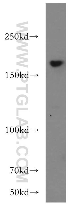 THADA Rabbit anti-Human, Mouse, Rat, Polyclonal, Proteintech:Antibodies:Primary
