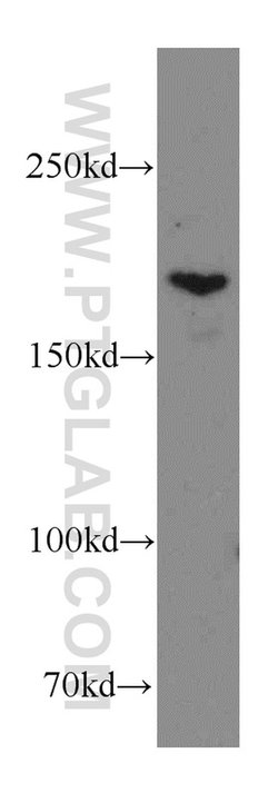 THADA Rabbit anti-Human, Mouse, Rat, Polyclonal, Proteintech:Antibodies:Primary