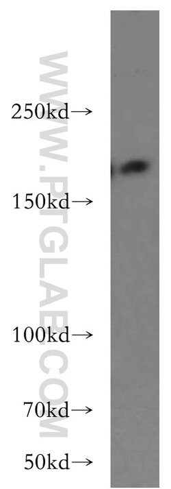 THADA Rabbit anti-Human, Mouse, Rat, Polyclonal, Proteintech:Antibodies:Primary