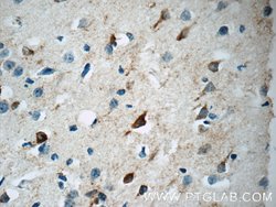 Netrin G1 Rabbit anti-Human, Mouse, Rat, Polyclonal, Proteintech:Antibodies:Primary