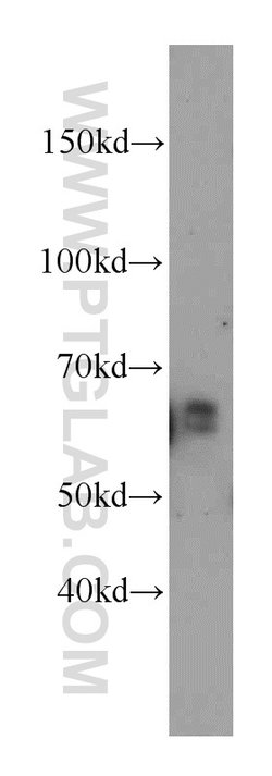 Netrin G1 Rabbit anti-Human, Mouse, Rat, Polyclonal, Proteintech:Antibodies:Primary