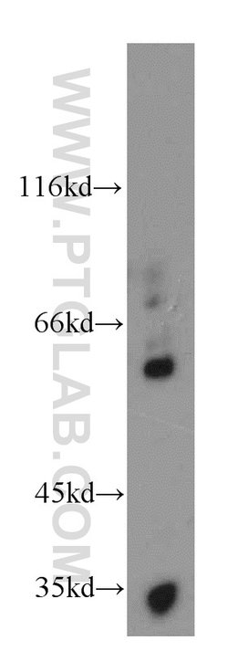Netrin G1 Rabbit anti-Human, Mouse, Rat, Polyclonal, Proteintech:Antibodies:Primary