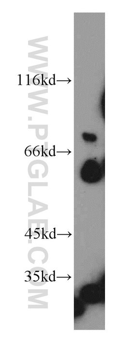 Netrin G1 Rabbit anti-Human, Mouse, Rat, Polyclonal, Proteintech:Antibodies:Primary