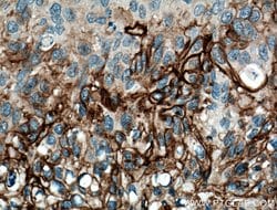 TGM1 Rabbit anti-Human, Mouse, Rat, Polyclonal, Proteintech:Antibodies:Primary