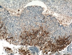 TGM1 Rabbit anti-Human, Mouse, Rat, Polyclonal, Proteintech:Antibodies:Primary