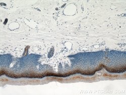 TGM1 Rabbit anti-Human, Mouse, Rat, Polyclonal, Proteintech:Antibodies:Primary