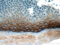 TGM1 Rabbit anti-Human, Mouse, Rat, Polyclonal, Proteintech:Antibodies:Primary