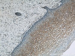TGM1 Rabbit anti-Human, Mouse, Rat, Polyclonal, Proteintech:Antibodies:Primary