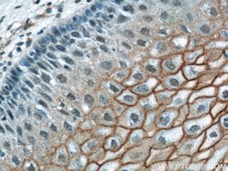 TGM1 Rabbit anti-Human, Mouse, Rat, Polyclonal, Proteintech:Antibodies:Primary