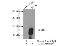 TGM1 Rabbit anti-Human, Mouse, Rat, Polyclonal, Proteintech:Antibodies:Primary