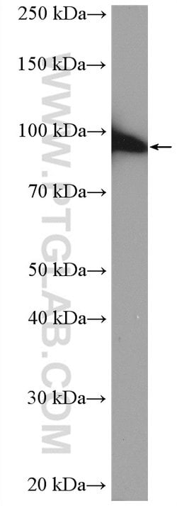 TGM1 Rabbit anti-Human, Mouse, Rat, Polyclonal, Proteintech:Antibodies:Primary