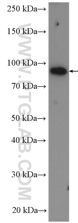 TGM1 Rabbit anti-Human, Mouse, Rat, Polyclonal, Proteintech:Antibodies:Primary