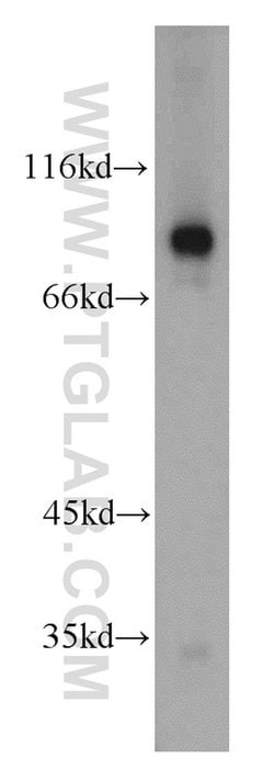 TGM1 Rabbit anti-Human, Mouse, Rat, Polyclonal, Proteintech:Antibodies:Primary