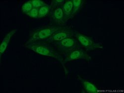 CUL4B Rabbit anti-Human, Mouse, Polyclonal, Proteintech:Antibodies:Primary