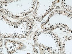 CUL4B Rabbit anti-Human, Mouse, Polyclonal, Proteintech:Antibodies:Primary