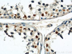 CUL4B Rabbit anti-Human, Mouse, Polyclonal, Proteintech:Antibodies:Primary