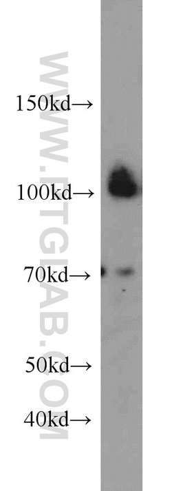 CUL4B Rabbit anti-Human, Mouse, Polyclonal, Proteintech:Antibodies:Primary