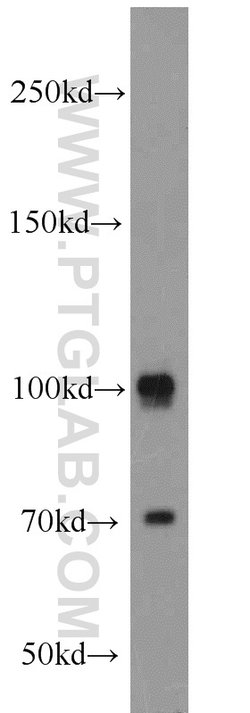 CUL4B Rabbit anti-Human, Mouse, Polyclonal, Proteintech:Antibodies:Primary