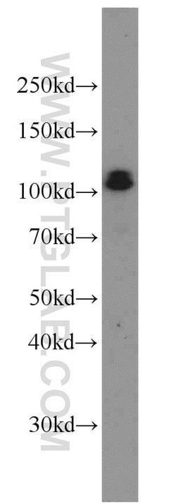 CUL4B Rabbit anti-Human, Mouse, Polyclonal, Proteintech:Antibodies:Primary