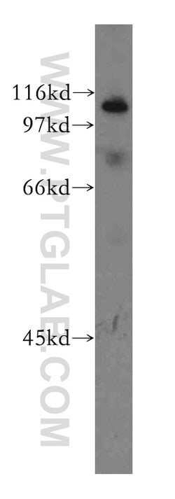 CUL4B Rabbit anti-Human, Mouse, Polyclonal, Proteintech:Antibodies:Primary
