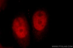 CUL4B Rabbit anti-Human, Mouse, Polyclonal, Proteintech:Antibodies:Primary