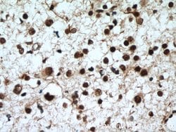 CUL4B Rabbit anti-Human, Mouse, Polyclonal, Proteintech:Antibodies:Primary