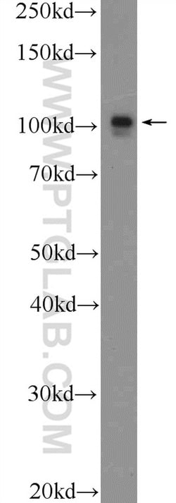 CUL4B Rabbit anti-Human, Mouse, Polyclonal, Proteintech:Antibodies:Primary