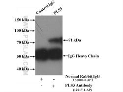 PLS3 Rabbit anti-Human, Mouse, Rat, Polyclonal, Proteintech:Anticuerpos:Anticuerpos
