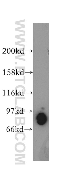 PDE4D Rabbit anti-Human, Mouse, Rat, Polyclonal, Proteintech 20 &mu;L;