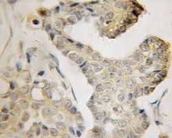 BVES Rabbit anti-Human, Mouse, Rat, Polyclonal, Proteintech:Antibodies:Primary