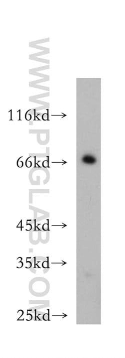BVES Rabbit anti-Human, Mouse, Rat, Polyclonal, Proteintech:Antibodies:Primary