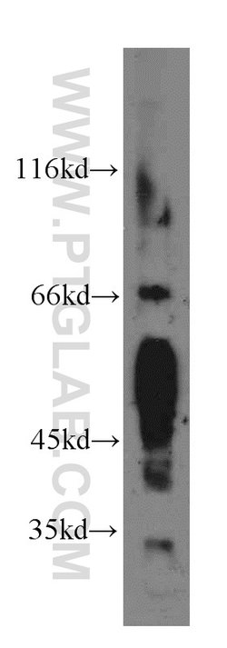 BVES Rabbit anti-Human, Mouse, Rat, Polyclonal, Proteintech:Antibodies:Primary