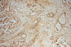 NME5 Rabbit anti-Human, Mouse, Rat, Polyclonal, Proteintech:Antibodies:Primary