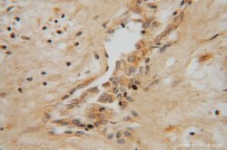 NME5 Rabbit anti-Human, Mouse, Rat, Polyclonal, Proteintech:Antibodies:Primary