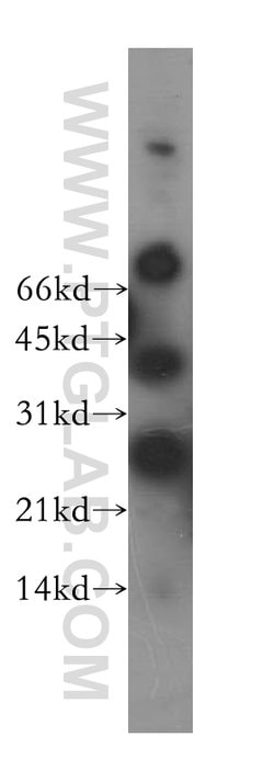 NME5 Rabbit anti-Human, Mouse, Rat, Polyclonal, Proteintech:Antibodies:Primary