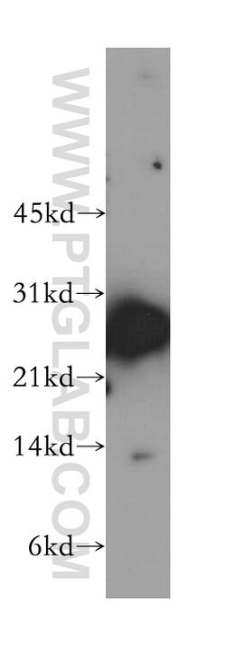 NME5 Rabbit anti-Human, Mouse, Rat, Polyclonal, Proteintech:Antibodies:Primary