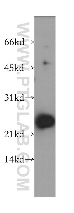 NME5 Rabbit anti-Human, Mouse, Rat, Polyclonal, Proteintech:Antibodies:Primary