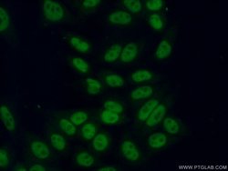 ASF/SF2 Rabbit anti-Human, Mouse, Rat, Polyclonal, Proteintech:Antibodies:Primary