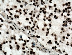 ASF/SF2 Rabbit anti-Human, Mouse, Rat, Polyclonal, Proteintech:Antibodies:Primary