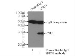 ASF/SF2 Rabbit anti-Human, Mouse, Rat, Polyclonal, Proteintech:Antibodies:Primary