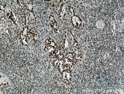 ASF/SF2 Rabbit anti-Human, Mouse, Rat, Polyclonal, Proteintech:Antibodies:Primary