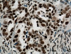 ASF/SF2 Rabbit anti-Human, Mouse, Rat, Polyclonal, Proteintech:Antibodies:Primary