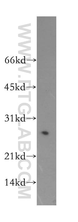 ASF/SF2 Rabbit anti-Human, Mouse, Rat, Polyclonal, Proteintech:Antibodies:Primary