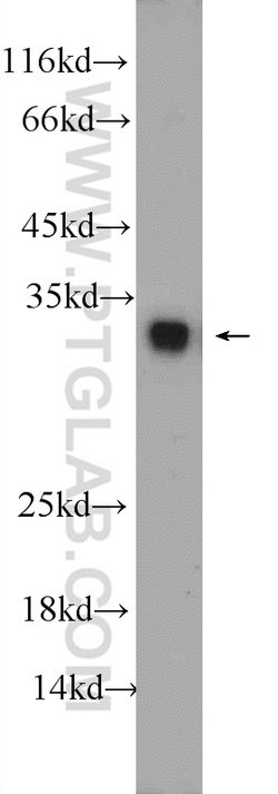 ASF/SF2 Rabbit anti-Human, Mouse, Rat, Polyclonal, Proteintech:Antibodies:Primary