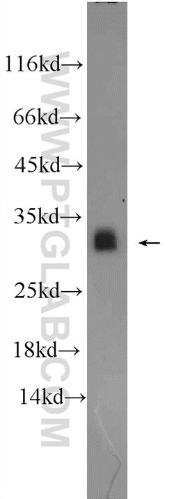 ASF/SF2 Rabbit anti-Human, Mouse, Rat, Polyclonal, Proteintech:Antibodies:Primary